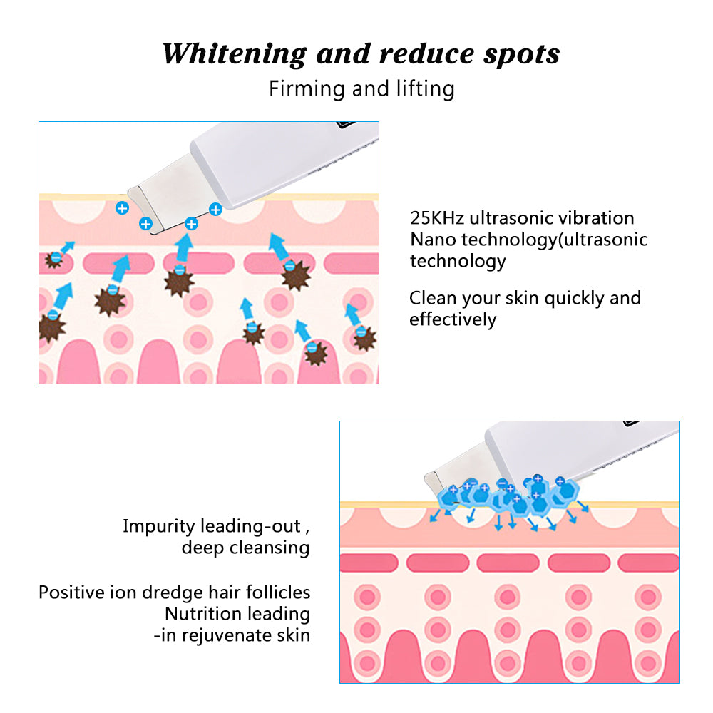 Ultrasonic Facial Cleanser & Pore Vacuum Device